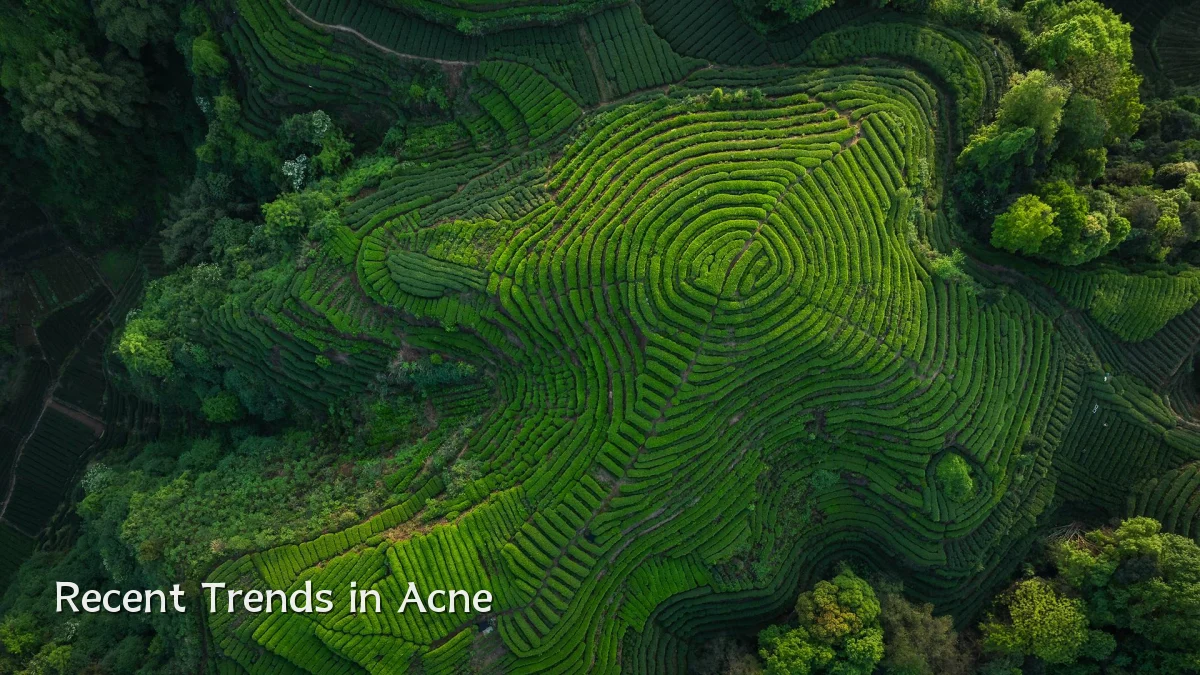 Recent Trends in Acne